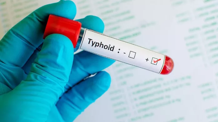 Typhoïde, Hamouro, foyer, épidémique, ARS, prévention, dépistage, vaccination
